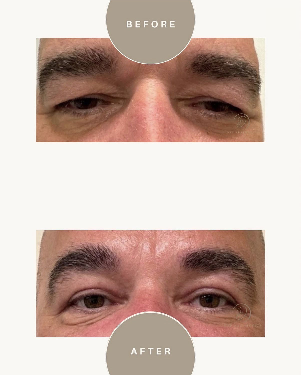 dsp-ooglidcorrectie-9